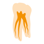 3Dfill